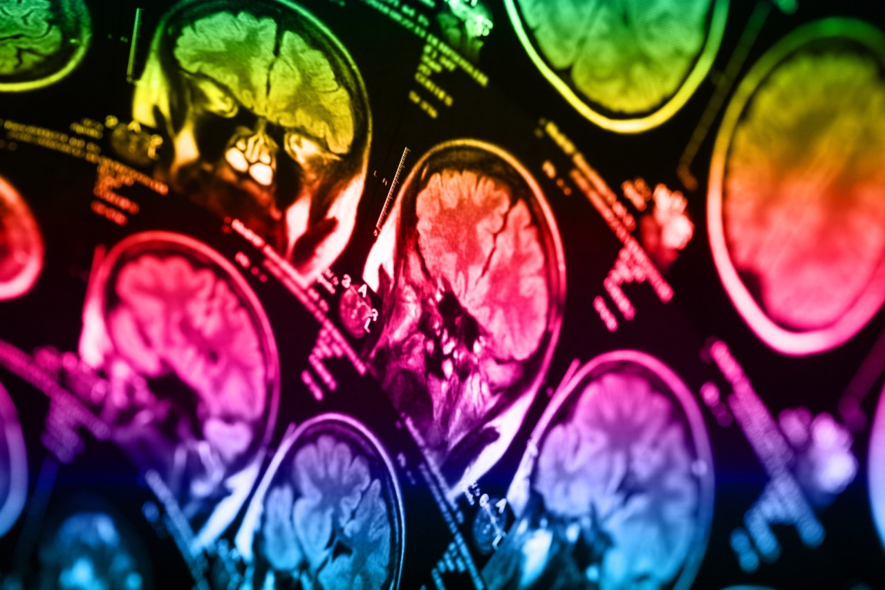 Should agencies be forced to reveal their mental health data? - Vimarsana News